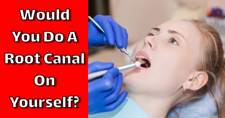 Would You Do A Root Canal On Yourself?